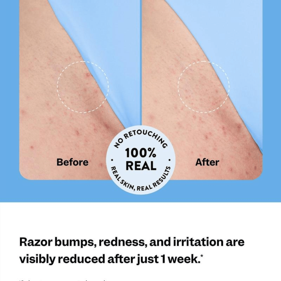 Malyora™️ Smoothing Serum